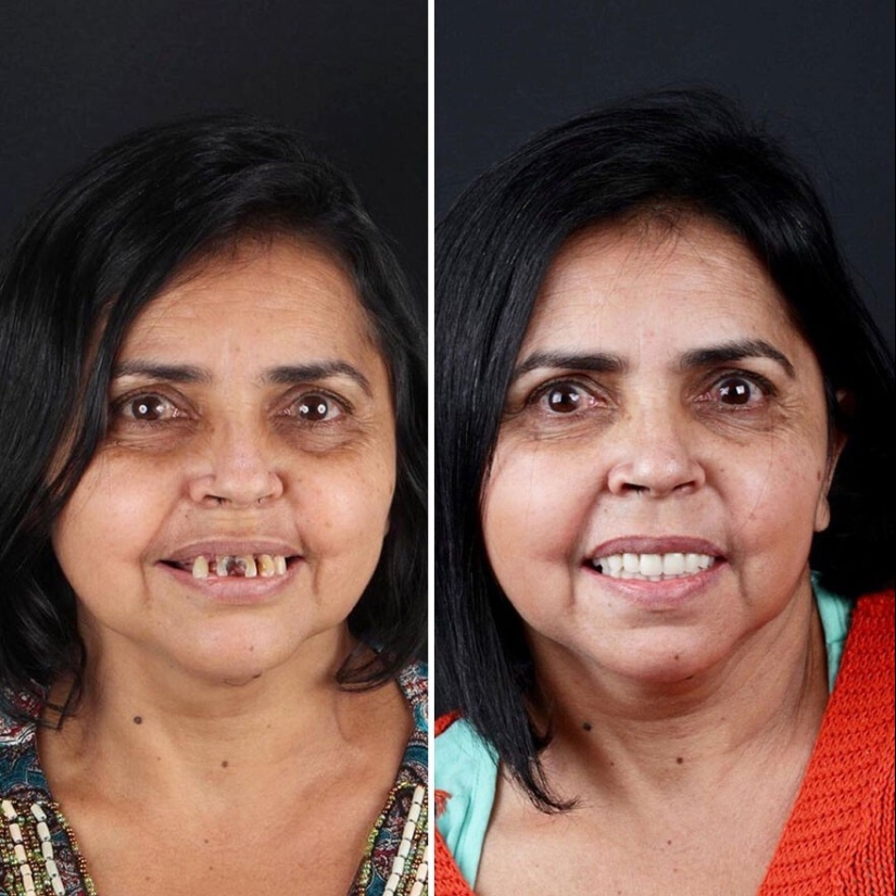 30 fotos antes y después de que la gente recuperara su sonrisa