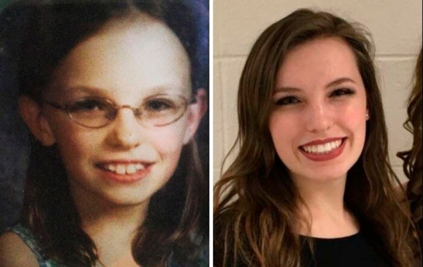30 "ugly ducklings" that have changed for the better with age