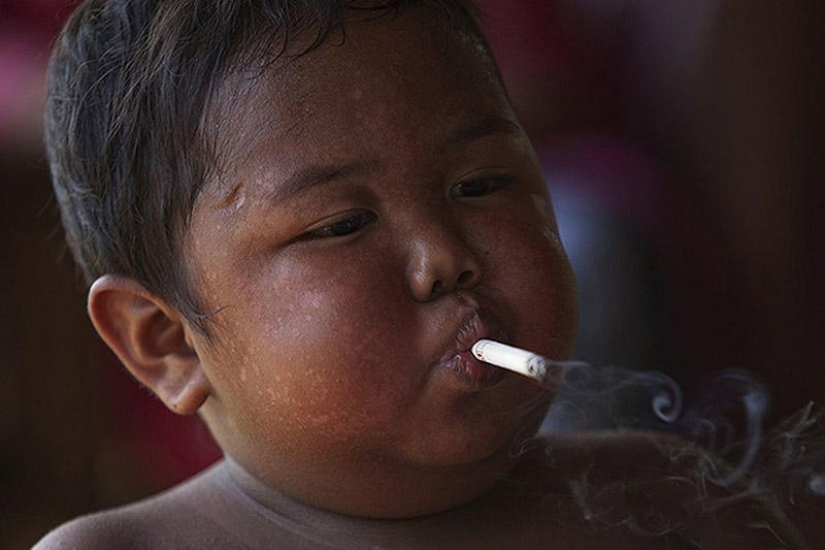 4-year-old Indonesian quit smoking and began to overeat