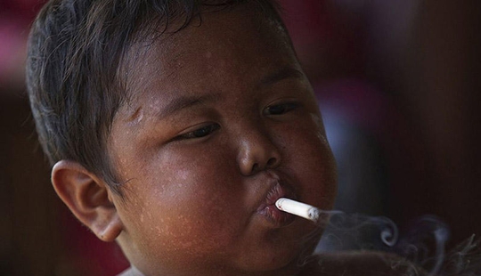 4-year-old Indonesian quit smoking and began to overeat