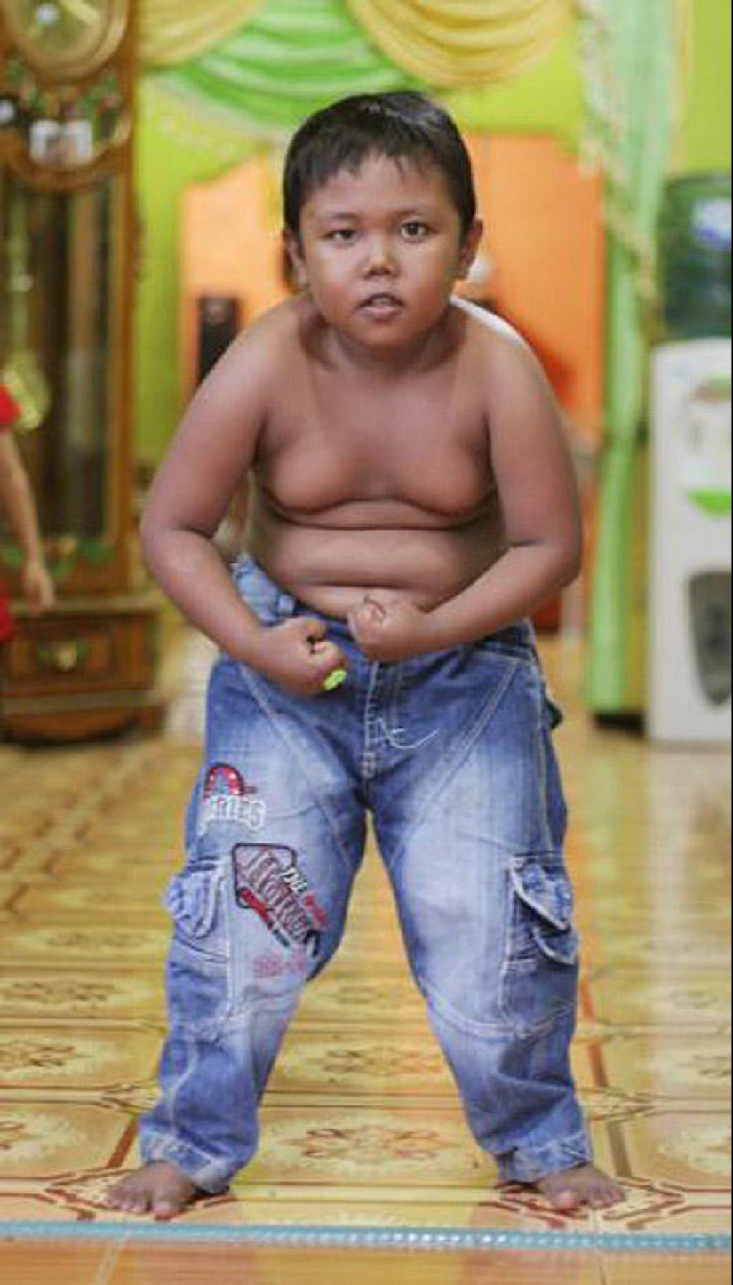 4-year-old Indonesian quit smoking and began to overeat