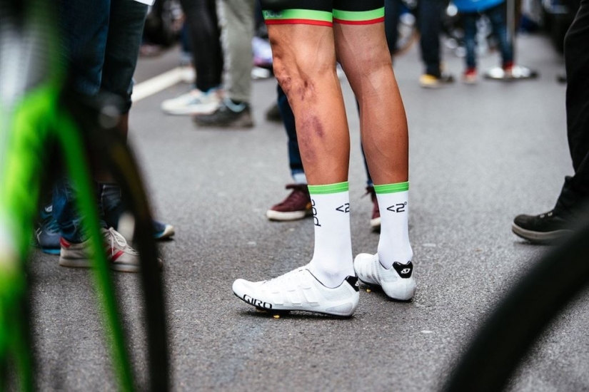 5 reasons why cyclists shave their legs