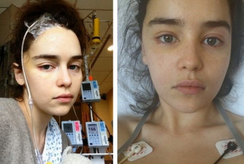 6 celebrities who have undergone severe surgery and were on the verge of death