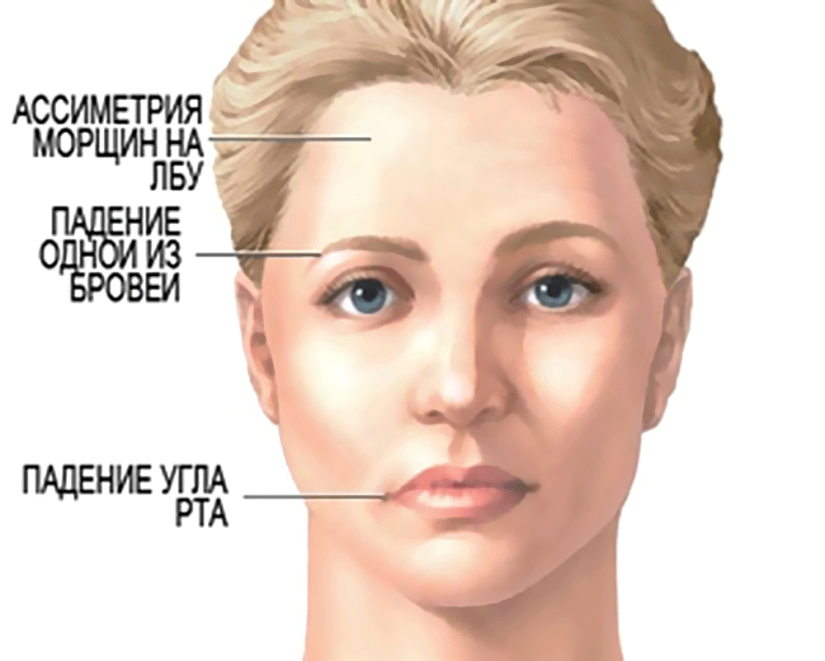 7 enfermedades graves que pueden ser identificadas por la cara