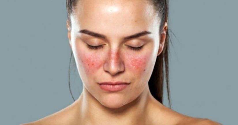 7 enfermedades graves que pueden ser identificadas por la cara