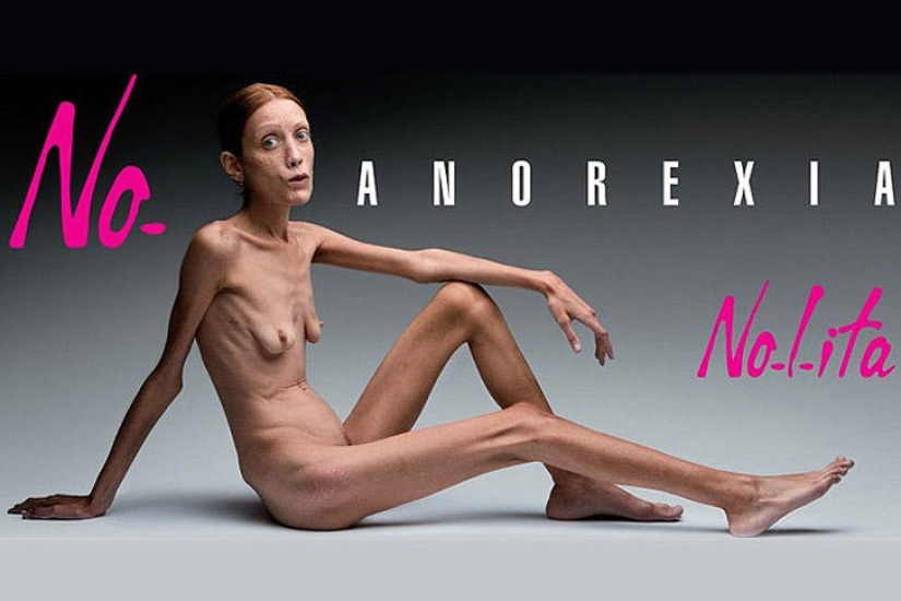 8 famosos que murieron de anorexia