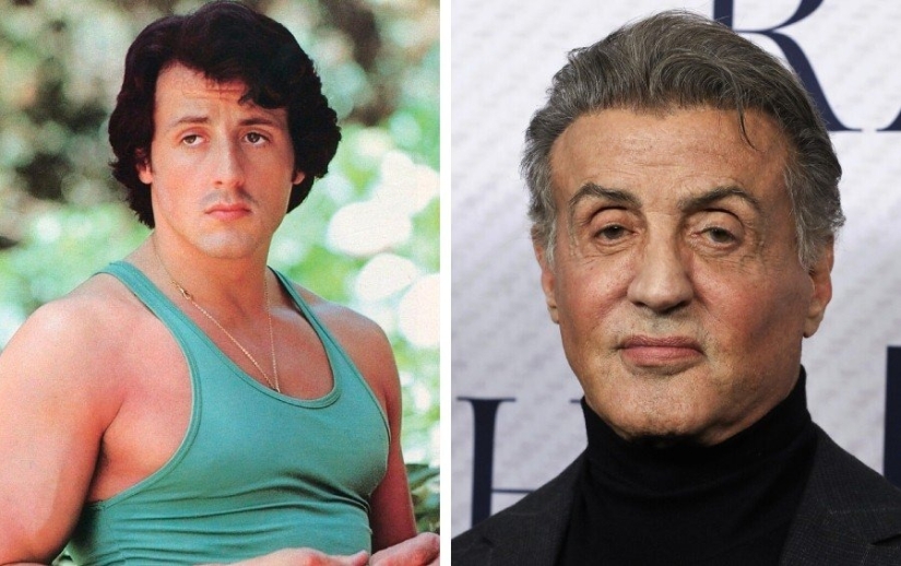 9 star men who have undergone plastic surgery: who got prettier and who regretted it