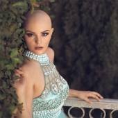 A 17-year-old girl struggling with cancer starred in a bold photo shoot without a wig