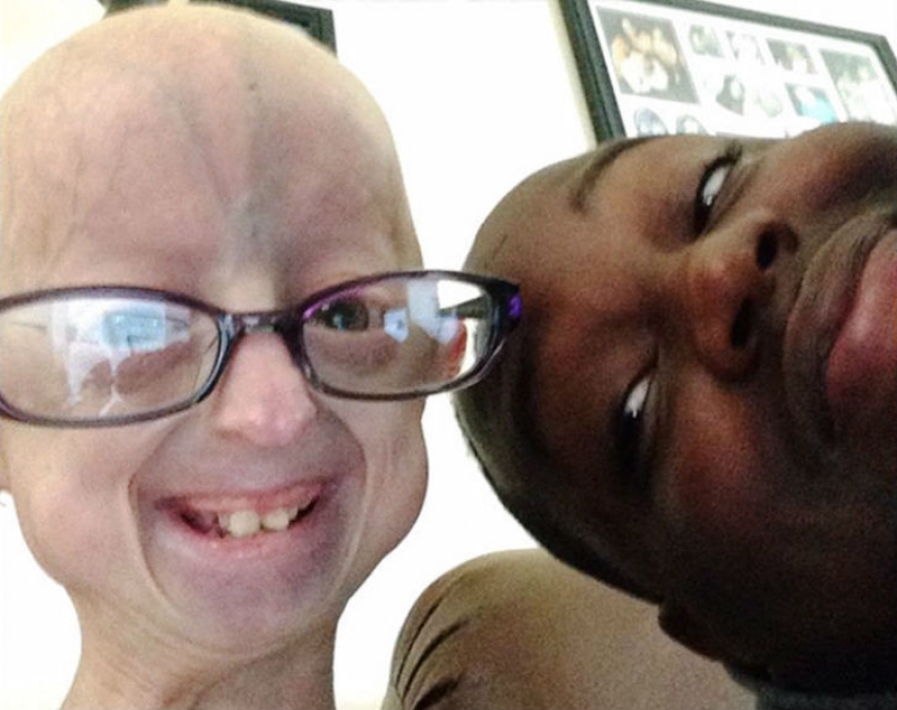 A girl with a rare disease befriends a strong man nicknamed the Beast