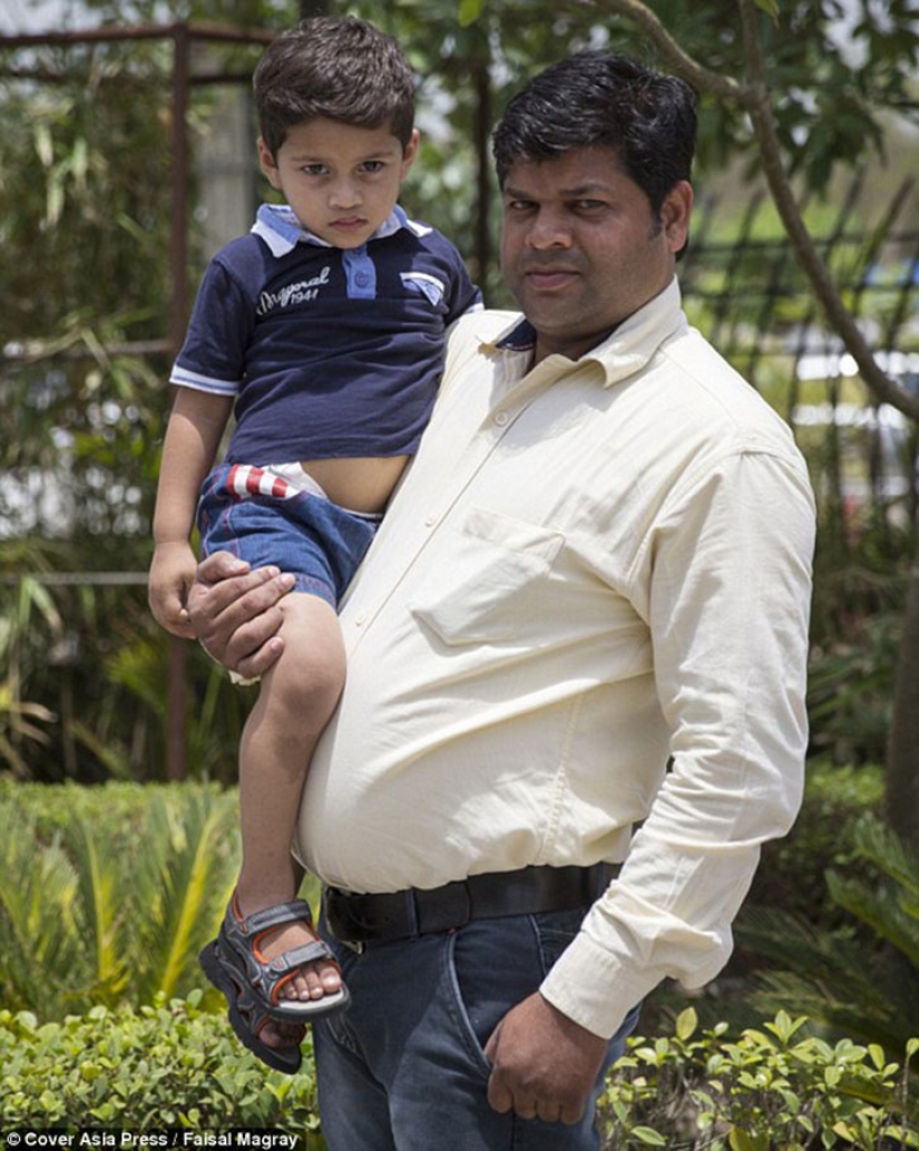 A two-year-old baby from India suffers from premature puberty
