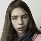 About Face: retratos fotográficos de personas que sufren de parálisis
