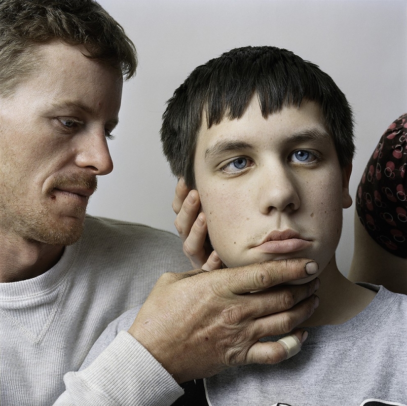 About Face: retratos fotográficos de personas que sufren de parálisis
