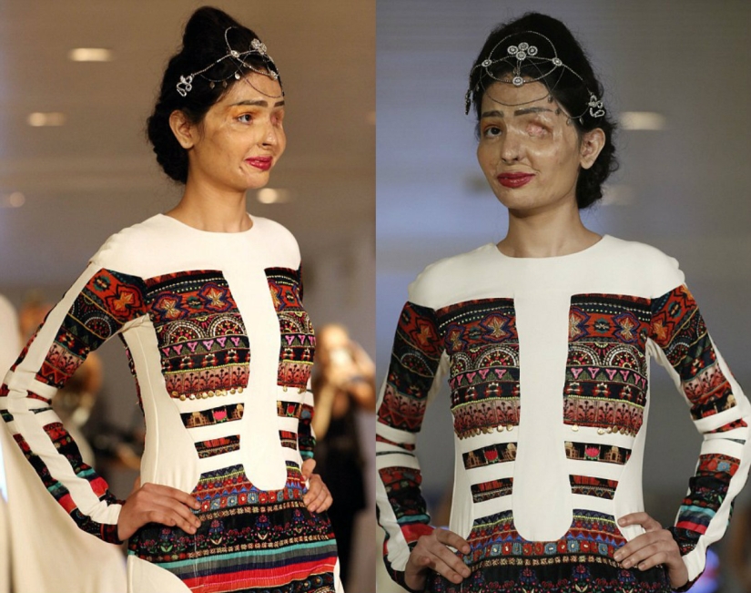 Acid dousing victim walked the runway at New York Fashion Week