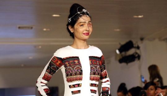 Acid dousing victim walked the runway at New York Fashion Week