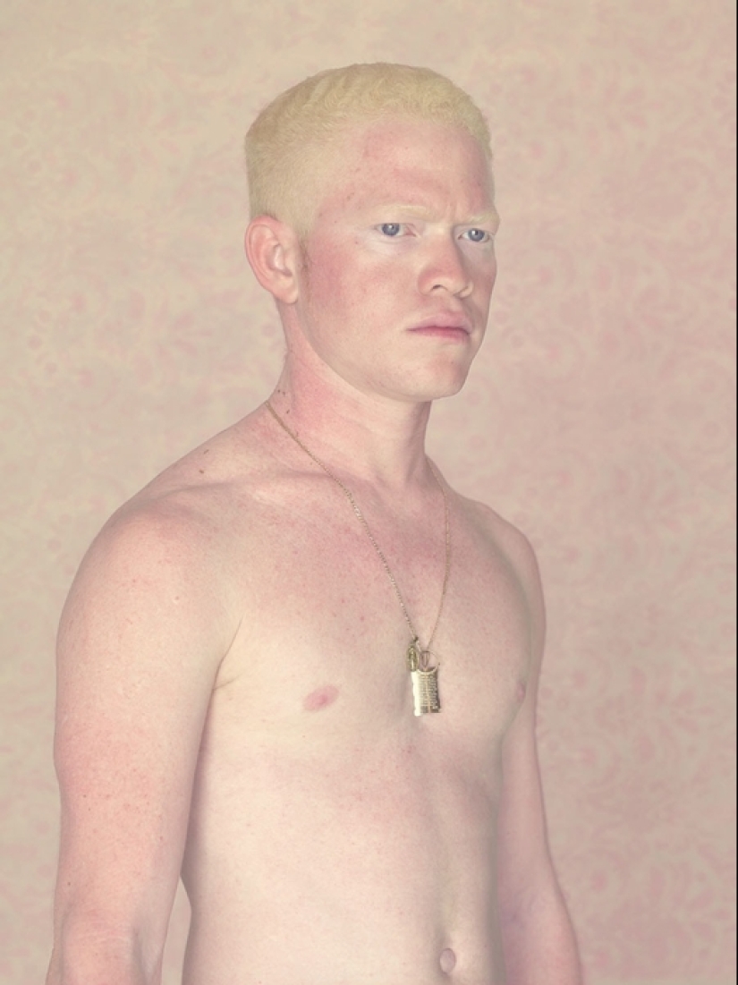 Albinos en la lente de Gustavo Lacerde