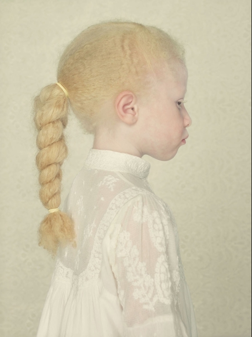 Albinos en la lente de Gustavo Lacerde