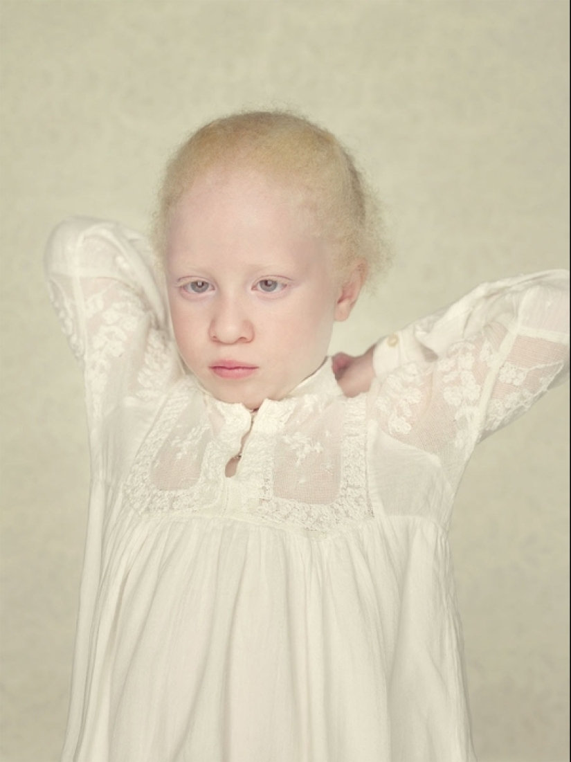 Albinos en la lente de Gustavo Lacerde