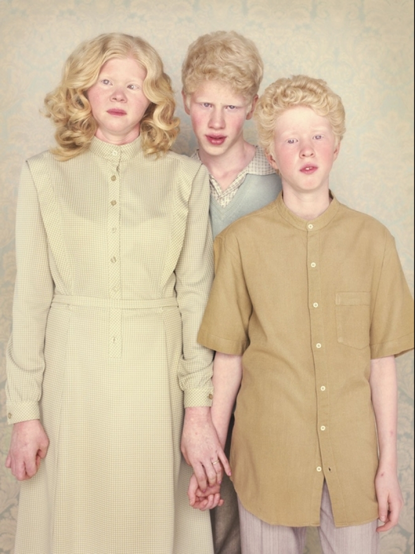Albinos in the lens of Gustavo Lacerde