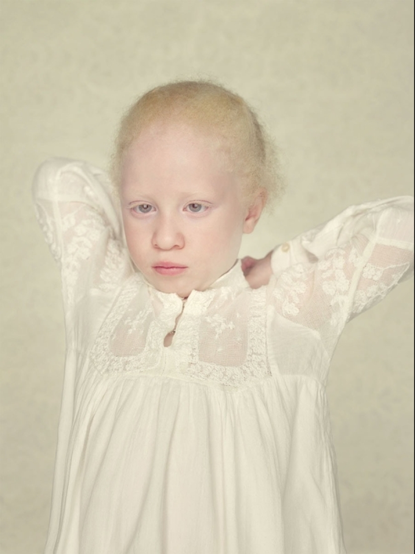 Albinos in the lens of Gustavo Lacerde