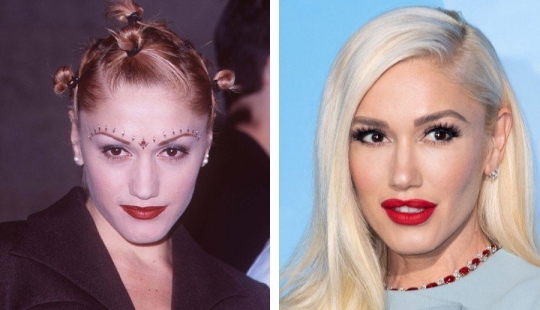 Almost like your own: 9 stars who knowingly made lip plastic surgery