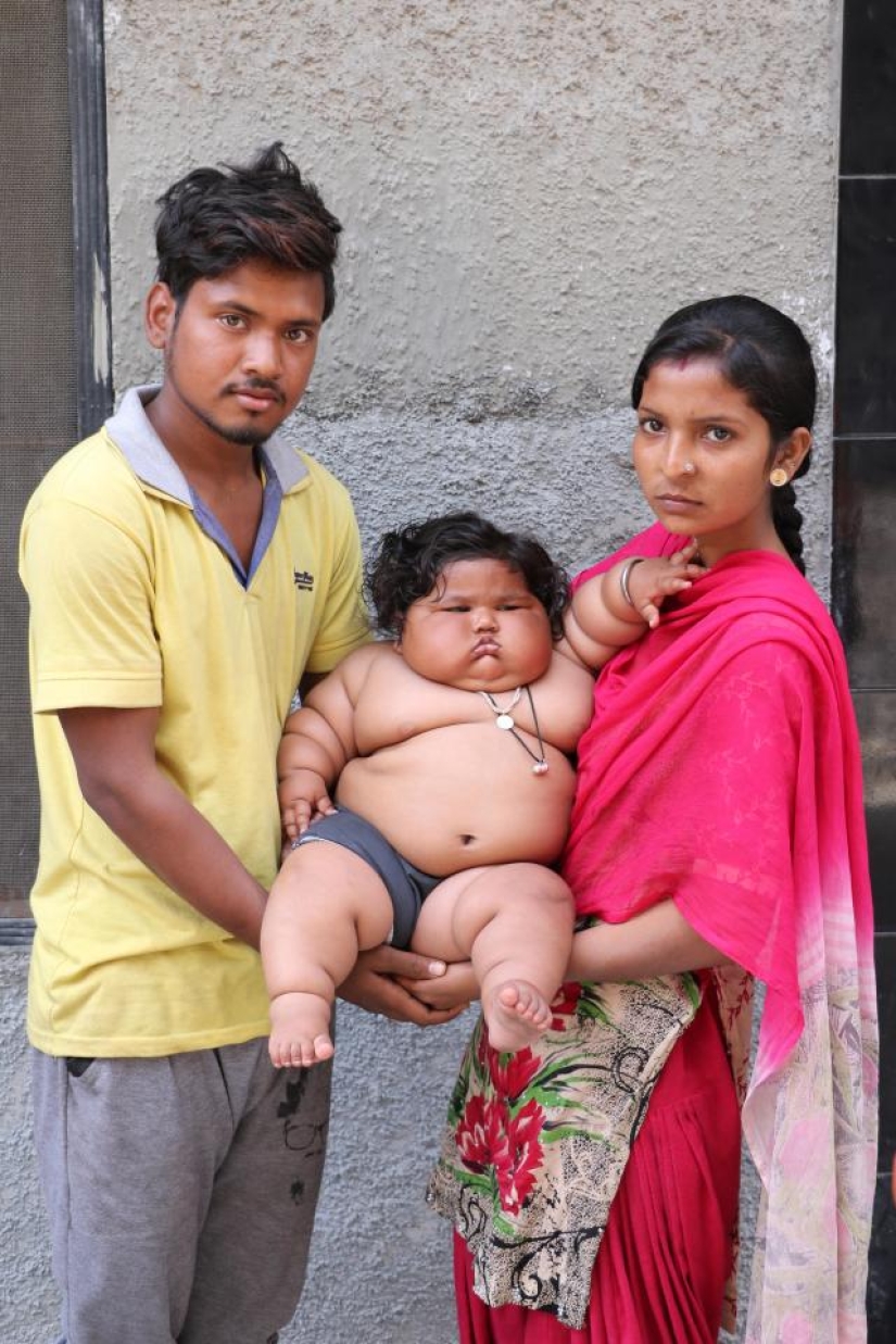 An 8-month-old girl weighs 17 kilograms, and doctors cannot diagnose her