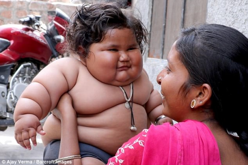 An 8-month-old girl weighs 17 kilograms, and doctors cannot diagnose her