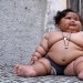 An 8-month-old girl weighs 17 kilograms, and doctors cannot diagnose her
