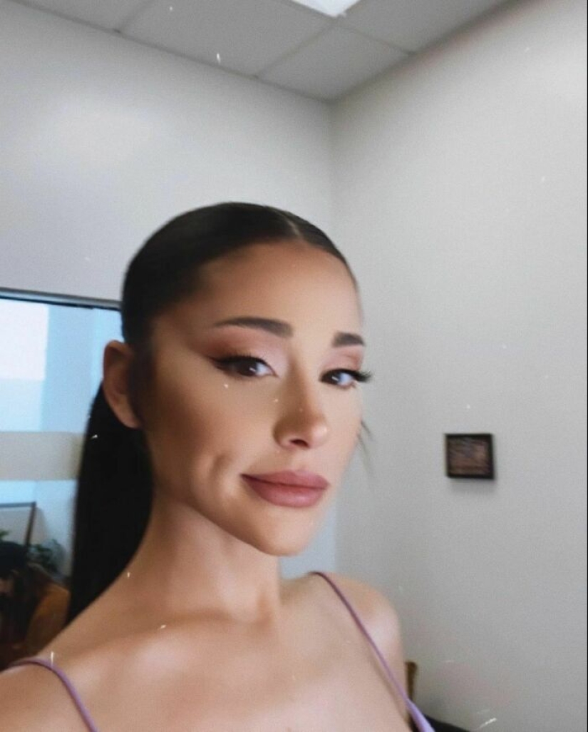 Ariana Grande Admits Using Botox and Lip Fillers To Change Her Appearance In The Past