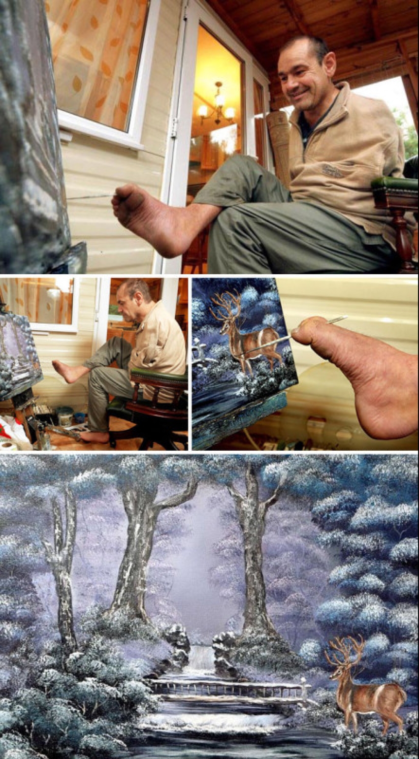 Artists with disabilities who have amazed the world with their talents