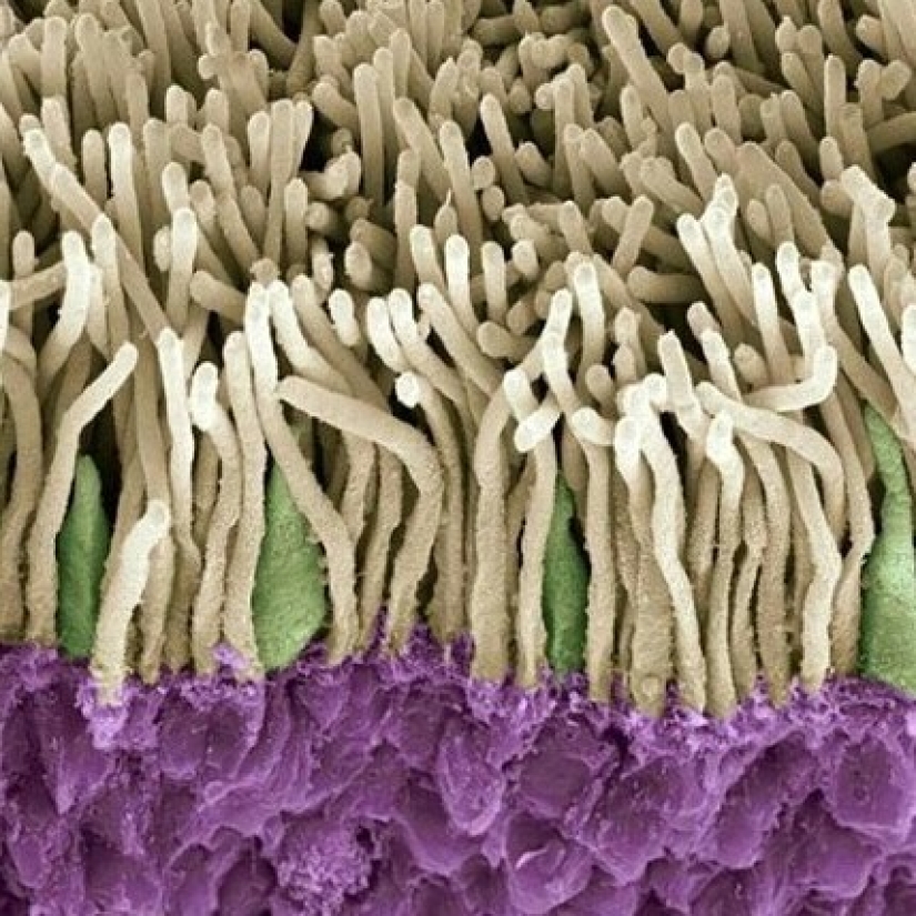 Belleza interior: un microbiólogo de Ufa muestra en Instagram los virus y bacterias que viven en nosotros