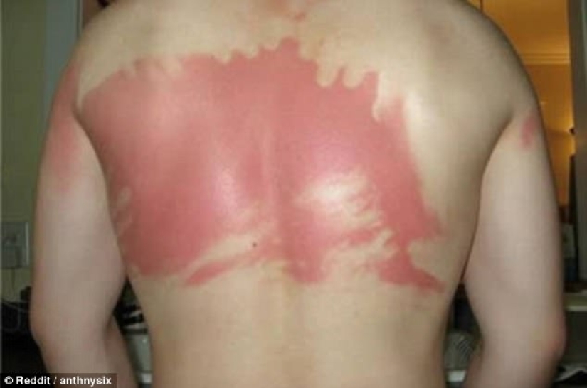 Black on top, white on the bottom — the most failed attempts to tan