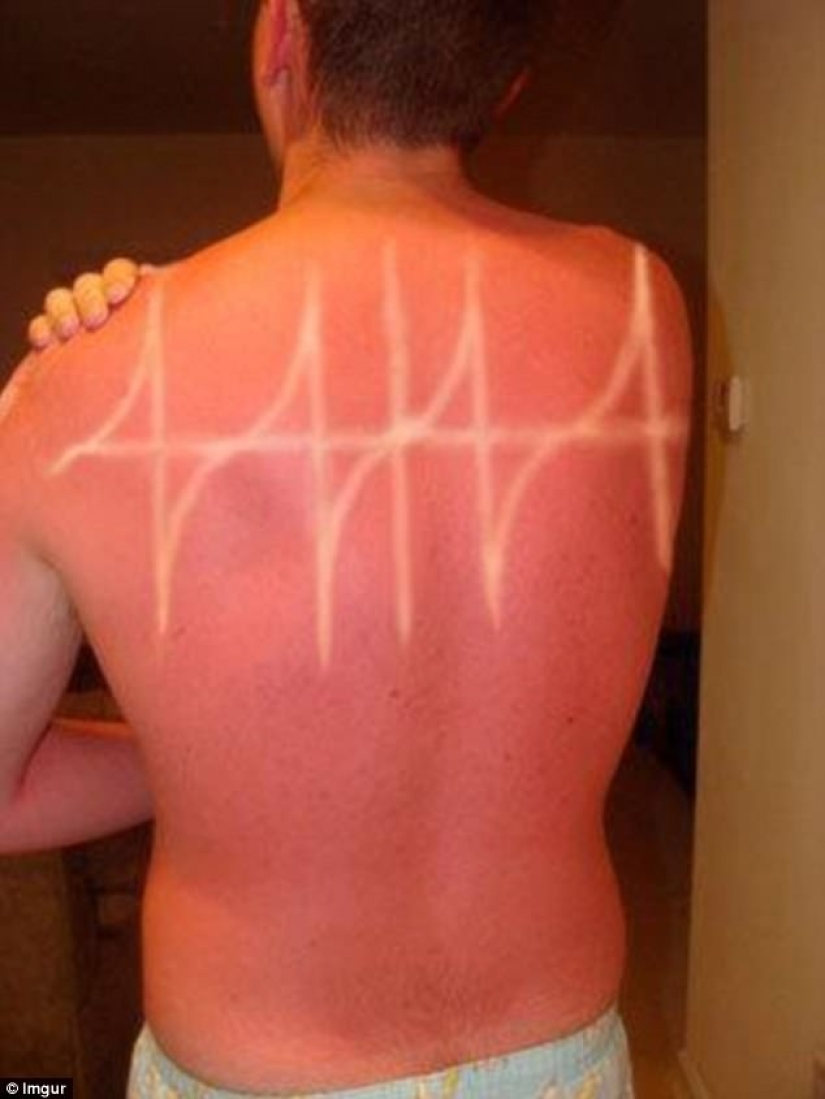 Black on top, white on the bottom — the most failed attempts to tan