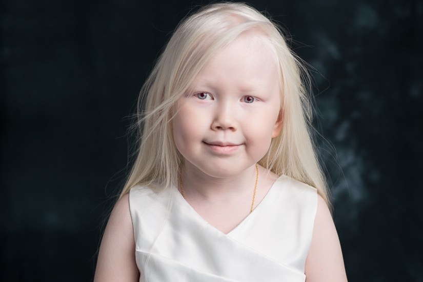 Blancanieves de Siberia: la modelo de 8 años con la apariencia más rara conmocionó a Internet