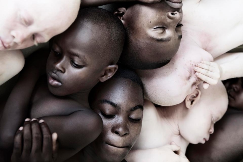 Blancura mortal: Increíbles retratos de albinos de Tanzania