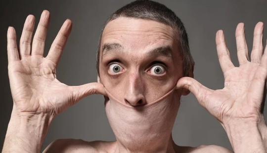 Cara de goma: cómo vive Harry Turner, el hombre con la piel más elástica del mundo