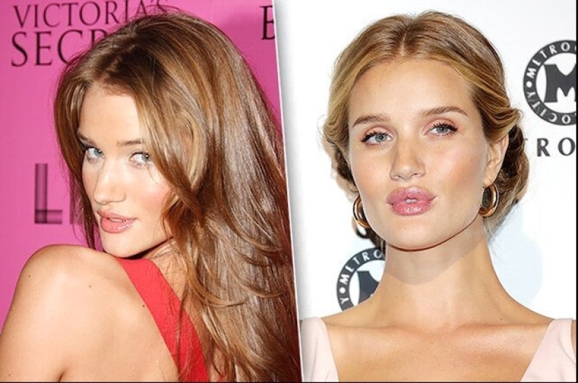 Celebrities Who Had Lip Augmentation: Photos That Surprise