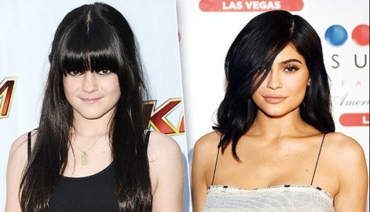 Celebrities Who Had Lip Augmentation: Photos That Surprise