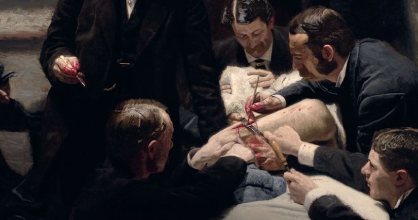 Cómo el doctor inglés Robert Liston mató a tres personas en una operación