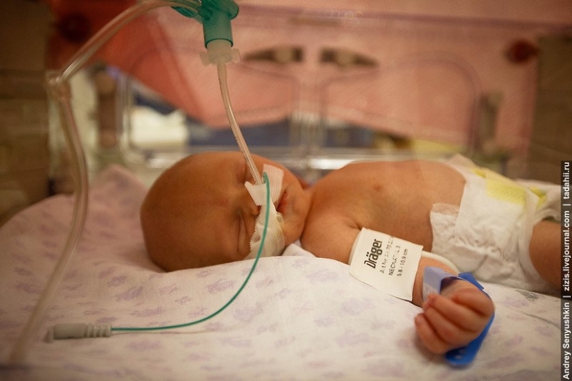¿Cómo se salvan los recién nacidos? Informe de cuidados intensivos pediátricos