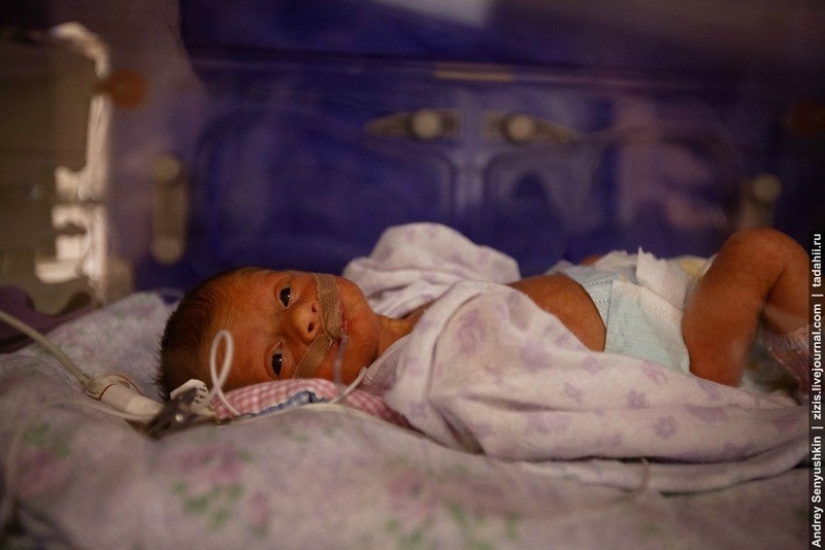 ¿Cómo se salvan los recién nacidos? Informe de cuidados intensivos pediátricos