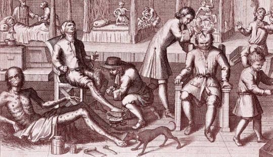 Cómo se trataban las enfermedades venéreas en los viejos tiempos: pesas de plomo, un látigo y ungüentos de mercurio