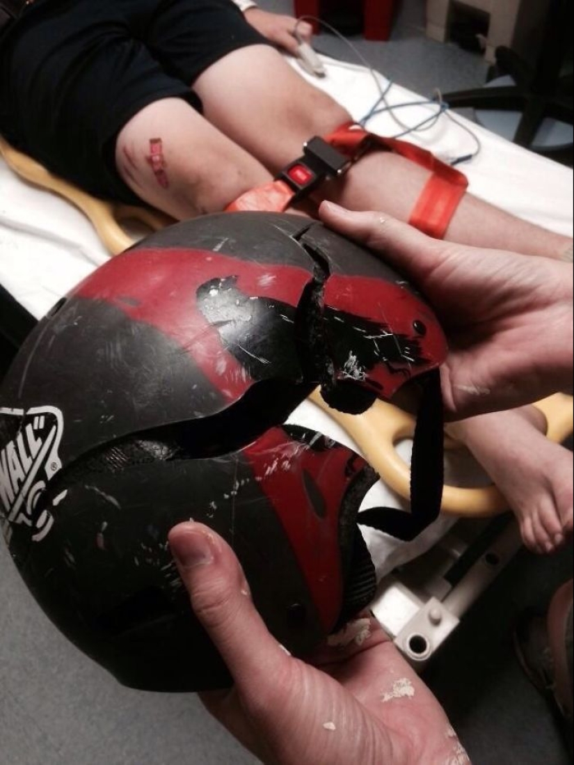 Cuida tu cabeza: víctimas de accidentes compartieron fotos de cascos que les salvaron la vida