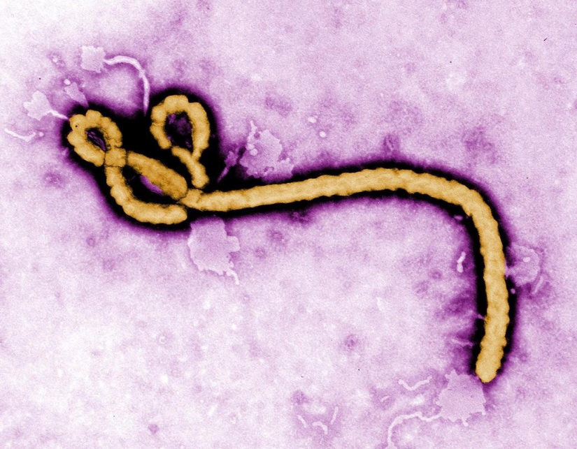 Ebola virus: the world is in a fever