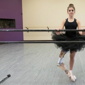 Ejemplo inspirador: una niña con una pierna protésica se convirtió en una bailarina maravillosa