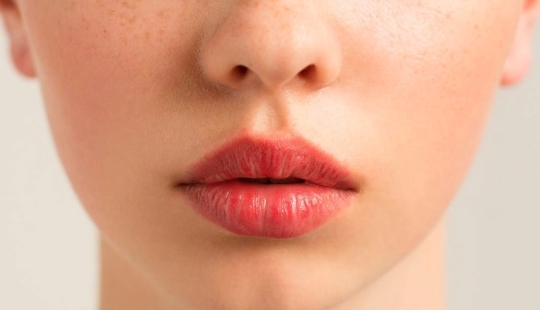 Eliminamos el rostro triste, insatisfecho junto con las arrugas nasolabiales y aumentamos el volumen de los labios