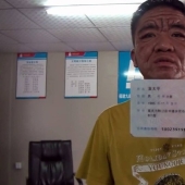 En 10 años, un joven chino se convirtió en un anciano