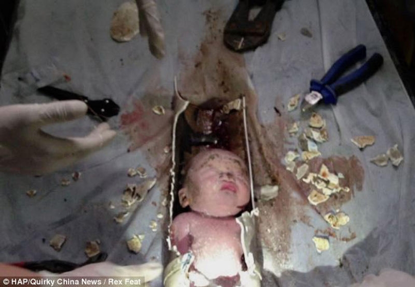 En China, un recién nacido fue rescatado después de ser tirado por el inodoro