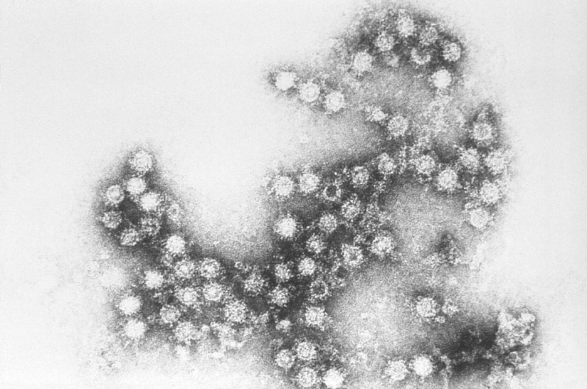 Everything you need to know about the flu virus