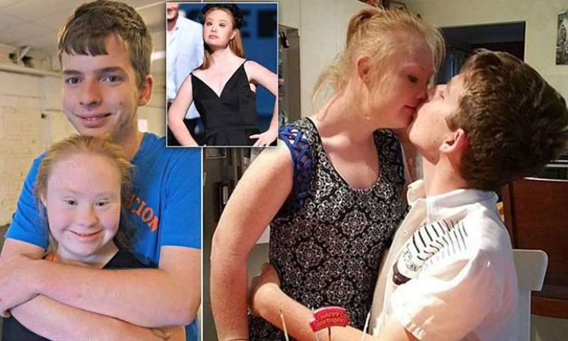 Fotos románticas de la modelo con síndrome de Down Madeleine Stewart y su novio