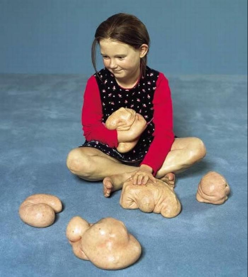 Gentiles monstruos de Patricia Piccinini